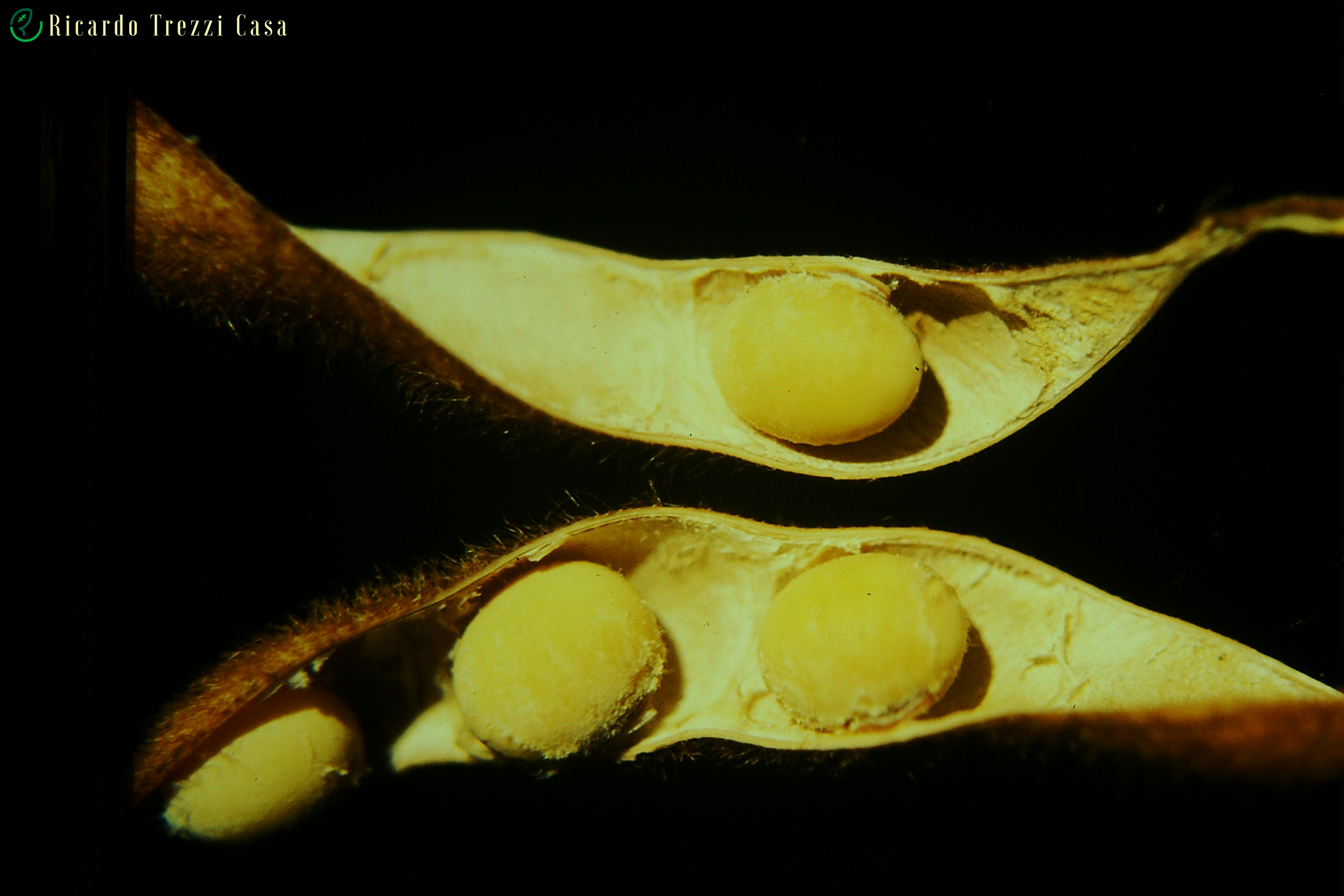 Peronospora manshurica